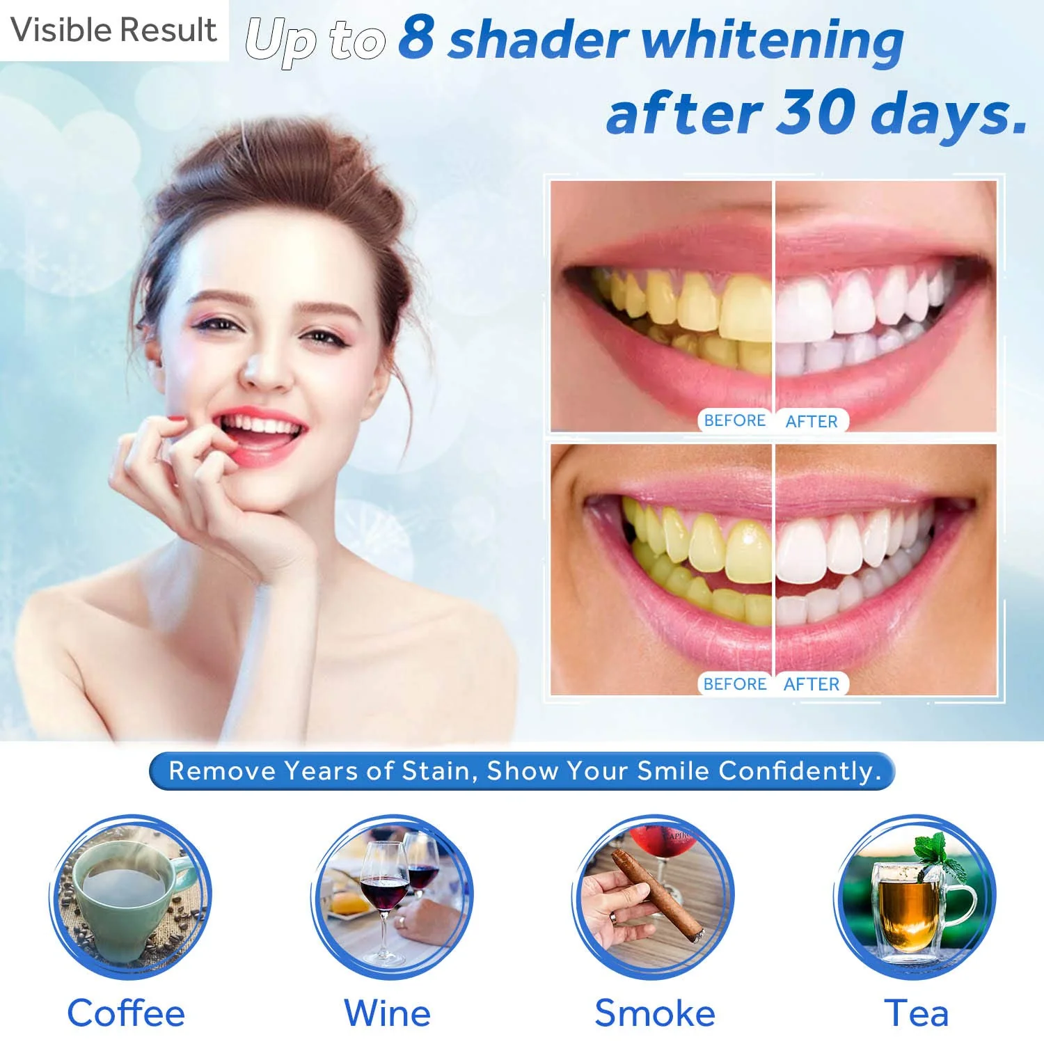 EZGO Teeth Whitening Gel Refill Syringes 22% Carbamide Peroxide 10 x 3ml - Image 4